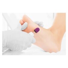 Csiszológyûrû 10mm durva thermo 10db/csomag